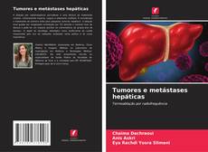 Buchcover von Tumores e metástases hepáticas