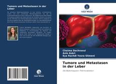 Bookcover of Tumore und Metastasen in der Leber