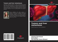 Portada del libro de Tumors and liver metastases