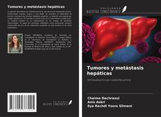 Tumores y metástasis hepáticas kitap kapağı