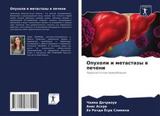 Опухоли и метастазы в печени kitap kapağı