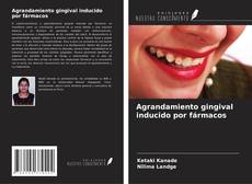 Bookcover of Agrandamiento gingival inducido por fármacos