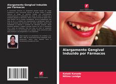 Bookcover of Alargamento Gengival Induzido por Fármacos
