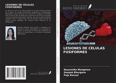 Capa do livro de LESIONES DE CÉLULAS FUSIFORMES 