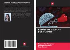 Buchcover von LESÕES DE CÉLULAS FUSIFORMES