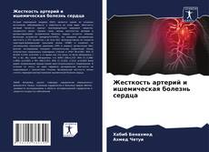 Bookcover of Жесткость артерий и ишемическая болезнь сердца