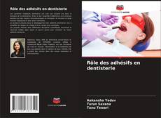 Bookcover of Rôle des adhésifs en dentisterie