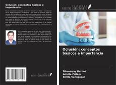 Bookcover of Oclusión: conceptos básicos e importancia