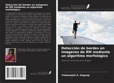 Couverture de Detección de bordes en imágenes de RM mediante un algoritmo morfológico