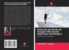 Bookcover of Detecção de Borda de Imagem MR Usando Algoritmo Morfológico