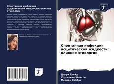 Buchcover von Спонтанная инфекция асцитической жидкости: влияние этиологии