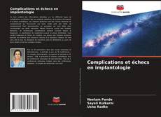 Buchcover von Complications et échecs en implantologie