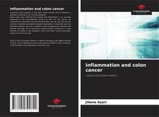 Bookcover of Inflammation and colon cancer