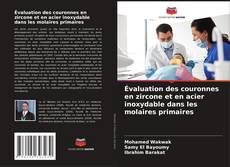 Buchcover von Évaluation des couronnes en zircone et en acier inoxydable dans les molaires primaires