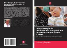 Borítókép a  Biopatologia da Hidrocefalia Congênita e Malformatio de Arnold Chiari - hoz