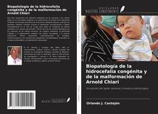 Обложка Biopatología de la hidrocefalia congénita y de la malformación de Arnold Chiari