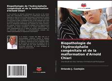 Обложка Biopathologie de l'hydrocéphalie congénitale et de la malformation d'Arnold Chiari