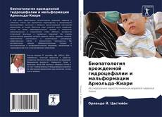 Buchcover von Биопатология врожденной гидроцефалии и мальформации Арнольда-Киари