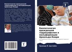 Bookcover of Биопатология врожденной гидроцефалии и мальформации Арнольда-Киари
