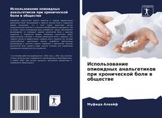 Bookcover of Использование опиоидных анальгетиков при хронической боли в обществе