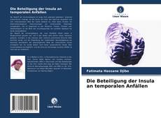 Bookcover of Die Beteiligung der Insula an temporalen Anfällen