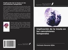 Bookcover of Implicación de la ínsula en las convulsiones temporales