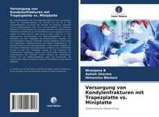 Bookcover of Versorgung von Kondylenfrakturen mit Trapezplatte vs. Miniplatte