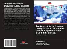 Capa do livro de Traitement de la fracture condylienne à l'aide d'une plaque trapézoïdale ou d'une mini plaque. 