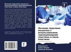 Couverture de Лечение перелома мыщелка с использованием трапециевидной пластины и мини-пластины