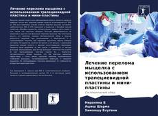 Capa do livro de Лечение перелома мыщелка с использованием трапециевидной пластины и мини-пластины 