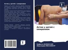 Buchcover von Астма у детей с ожирением