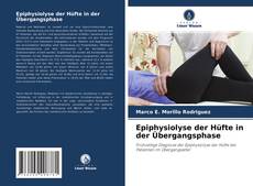 Epiphysiolyse der Hüfte in der Übergangsphase kitap kapağı