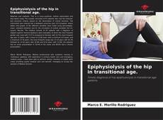 Bookcover of Epiphysiolysis of the hip in transitional age.