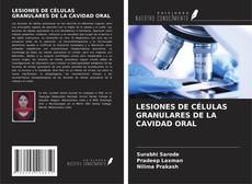 Bookcover of LESIONES DE CÉLULAS GRANULARES DE LA CAVIDAD ORAL