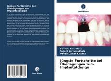 Portada del libro de Jüngste Fortschritte bei Überlegungen zum Implantatdesign