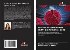 Couverture de Il virus di Epstein-Barr (EBV) nei tumori al seno