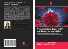 Bookcover of Vírus Epstein-Barr (EBV) em tumores mamários