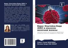 Capa do livro de Вирус Эпштейна-Барр (EBV) в опухолях молочной железы 