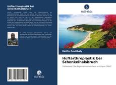 Portada del libro de Hüftarthroplastik bei Schenkelhalsbruch