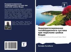 Copertina di Эндопротезирование тазобедренного сустава при переломе шейки бедра