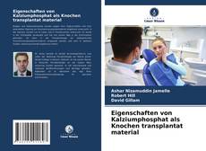Buchcover von Eigenschaften von Kalziumphosphat als Knochen transplantat material