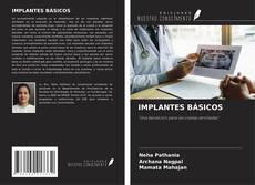 Bookcover of IMPLANTES BÁSICOS