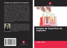 Projeto de Superfície do Implante kitap kapağı