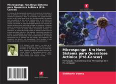 Buchcover von Microsponge- Um Novo Sistema para Queratose Actínica (Pré-Cancer)