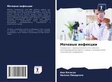 Buchcover von Мочевые инфекции