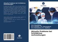 Capa do livro de Aktuelle Probleme bei Schilddrüse nerkrankungen 
