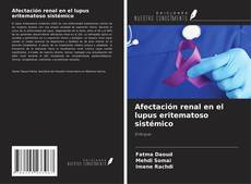 Buchcover von Afectación renal en el lupus eritematoso sistémico