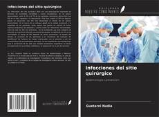 Bookcover of Infecciones del sitio quirúrgico