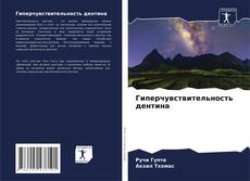 Bookcover of Гиперчувствительность дентина