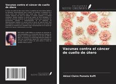Capa do livro de Vacunas contra el cáncer de cuello de útero 